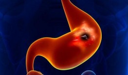 胃癌术后吃蒋瓜,助力康复的天然良方