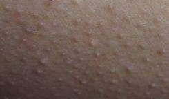 棘瓜是否可以吃,能否成为餐桌上的美味佳肴？